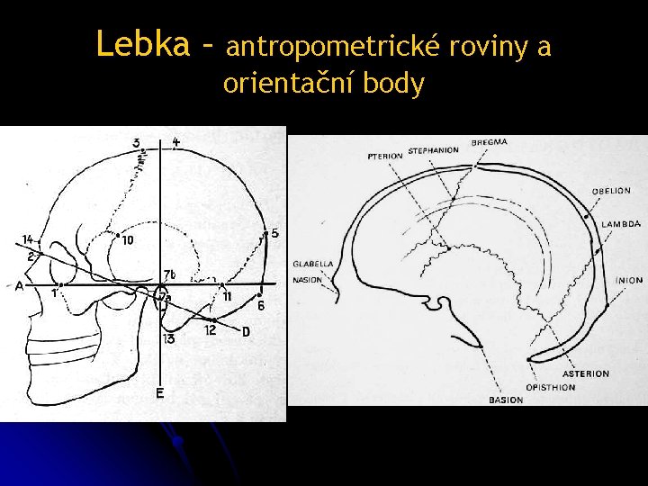 Lebka – antropometrické roviny a orientační body 