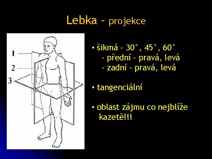 Lebka – projekce • šikmá – 30°, 45°, 60° - přední – pravá, levá