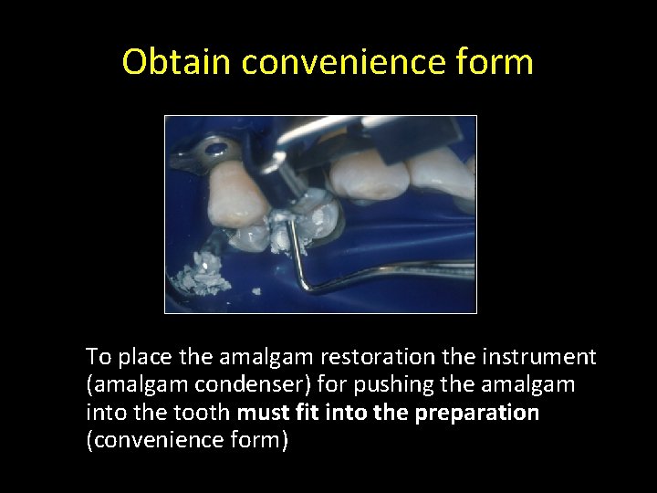Obtain convenience form To place the amalgam restoration the instrument (amalgam condenser) for pushing