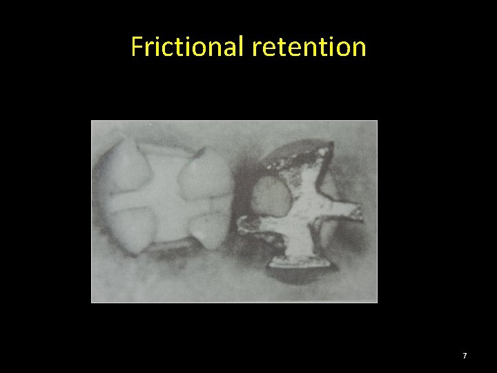 Frictional retention 7 