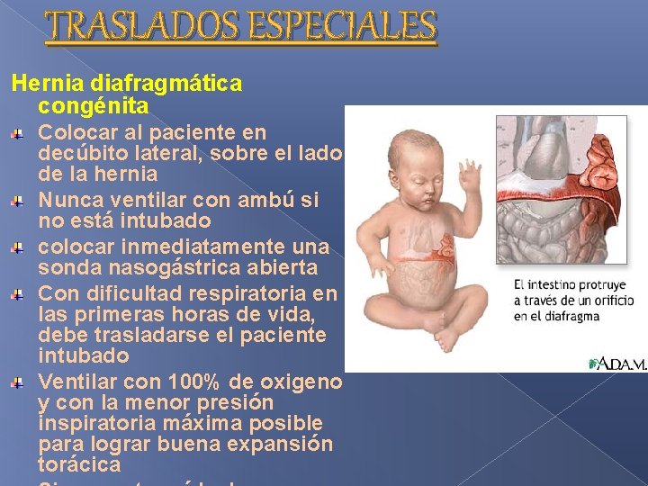 TRASLADOS ESPECIALES Hernia diafragmática congénita Colocar al paciente en decúbito lateral, sobre el lado