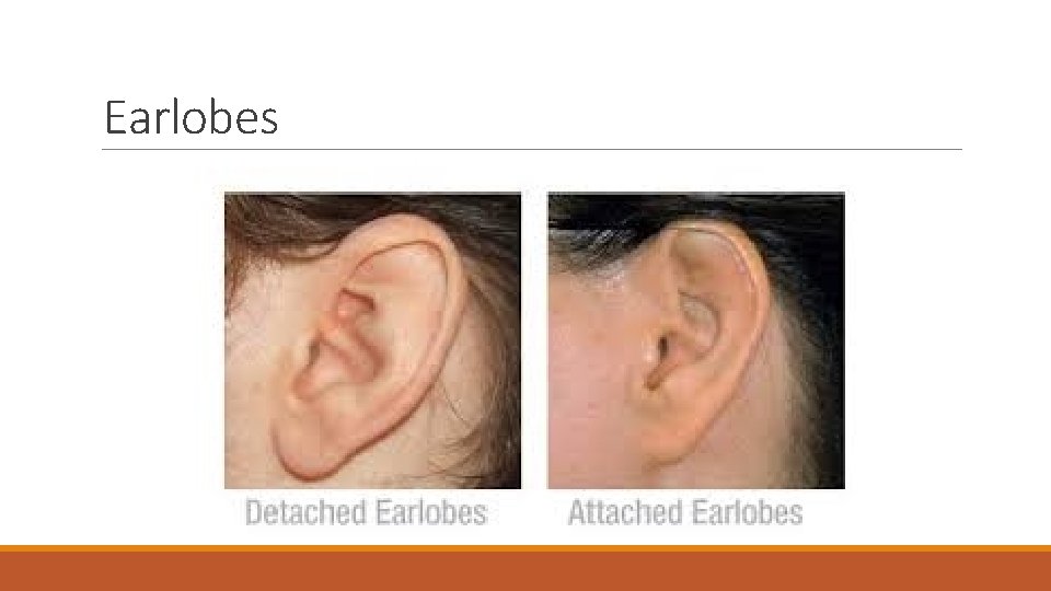 Earlobes 