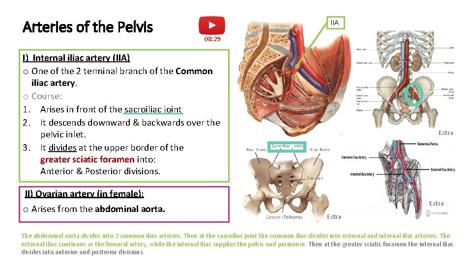 Arteries of the Pelvis IIA 08: 29 I) Internal iliac artery (IIA) o One