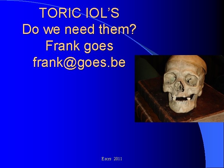 TORIC IOL’S Do we need them? Frank goes frank@goes. be Escrs 2011 TORIC IOL’S Do we need them? Frank goes frank@goes. be Escrs 2011