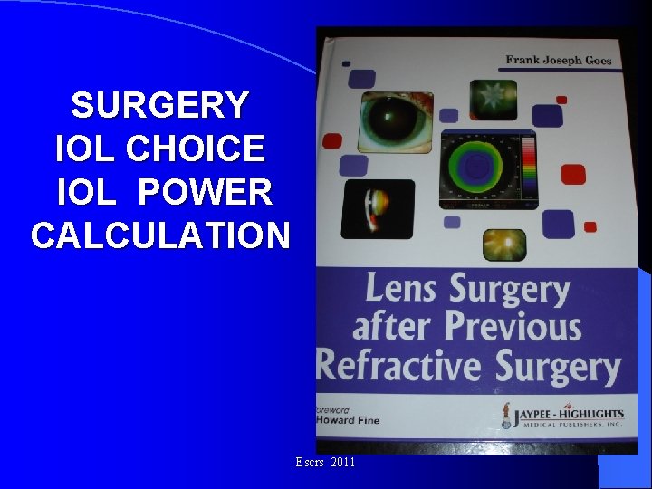 SURGERY IOL CHOICE IOL POWER CALCULATION Escrs 2011 SURGERY IOL CHOICE IOL POWER CALCULATION Escrs 2011