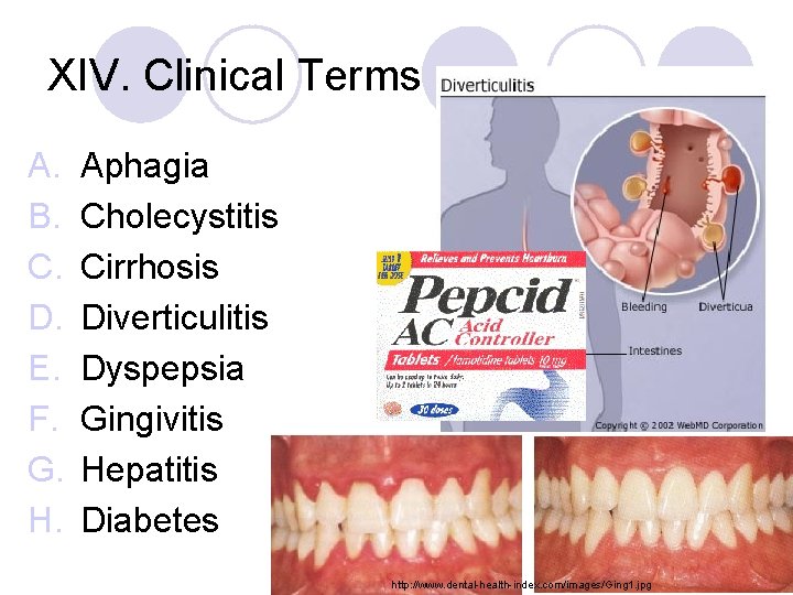 XIV. Clinical Terms A. B. C. D. E. F. G. H. Aphagia Cholecystitis Cirrhosis