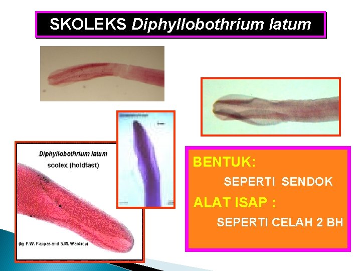SKOLEKS Diphyllobothrium latum BENTUK: SEPERTI SENDOK ALAT ISAP : SEPERTI CELAH 2 BH SKOLEKS Diphyllobothrium latum BENTUK: SEPERTI SENDOK ALAT ISAP : SEPERTI CELAH 2 BH