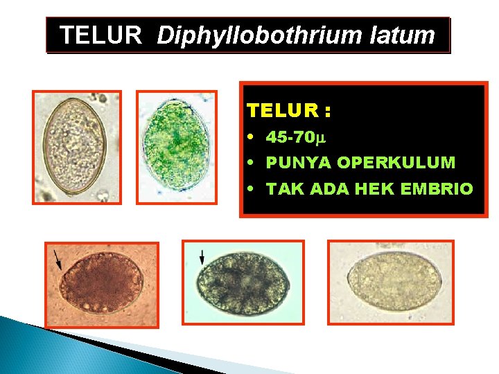TELUR Diphyllobothrium latum TELUR : • 45 -70 • PUNYA OPERKULUM • TAK ADA TELUR Diphyllobothrium latum TELUR : • 45 -70 • PUNYA OPERKULUM • TAK ADA