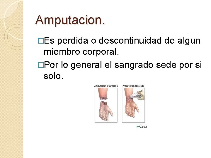 Amputacion. �Es perdida o descontinuidad de algun miembro corporal. �Por lo general el sangrado