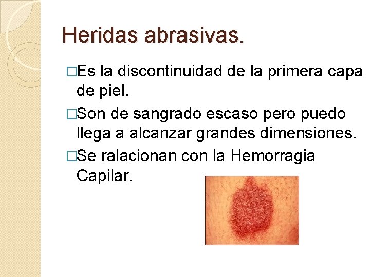 Heridas abrasivas. �Es la discontinuidad de la primera capa de piel. �Son de sangrado