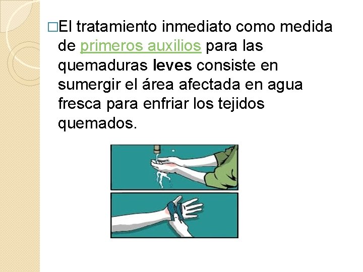 �El tratamiento inmediato como medida de primeros auxilios para las quemaduras leves consiste en