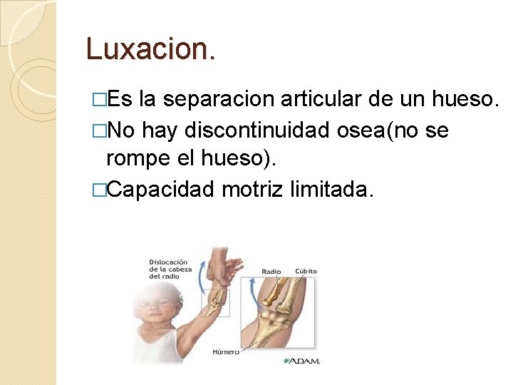Luxacion. �Es la separacion articular de un hueso. �No hay discontinuidad osea(no se rompe