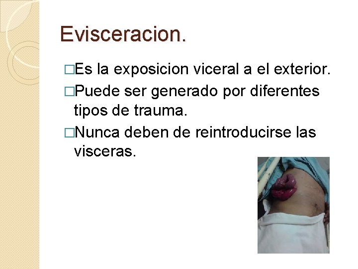 Evisceracion. �Es la exposicion viceral a el exterior. �Puede ser generado por diferentes tipos