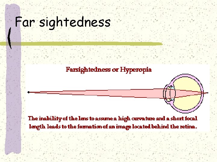 Far sightedness 