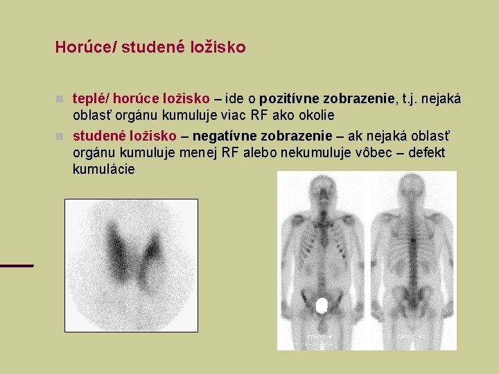 Horúce/ studené ložisko teplé/ horúce ložisko – ide o pozitívne zobrazenie, t. j. nejaká