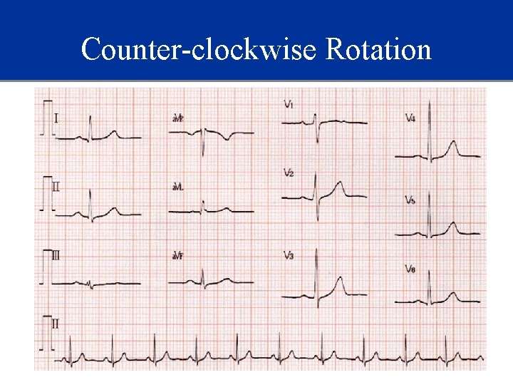 Counter-clockwise Rotation 