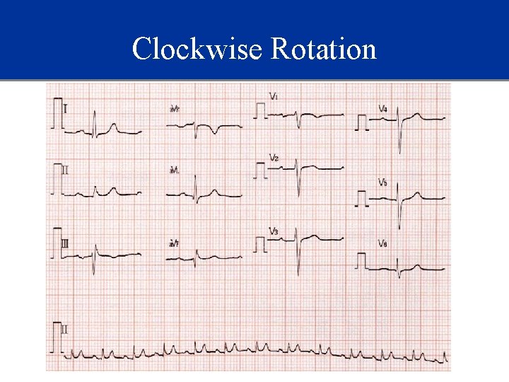 Clockwise Rotation 