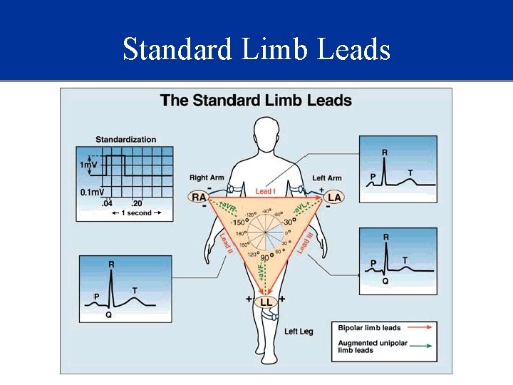 Standard Limb Leads 