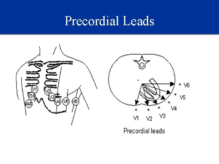 Precordial Leads 