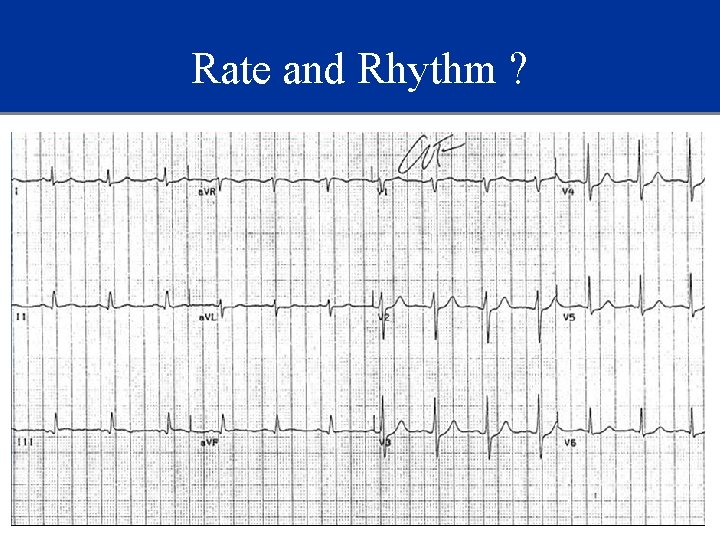 Rate and Rhythm ? 