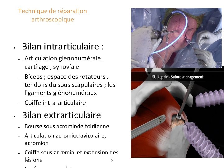 Technique de réparation arthroscopique Bilan intrarticulaire : • – – – Articulation glénohumérale ,