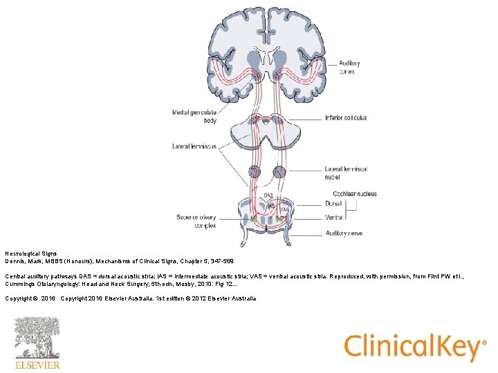 Neurological Signs Dennis, Mark, MBBS (Honours), Mechanisms of Clinical Signs, Chapter 5, 347 -569 Neurological Signs Dennis, Mark, MBBS (Honours), Mechanisms of Clinical Signs, Chapter 5, 347 -569