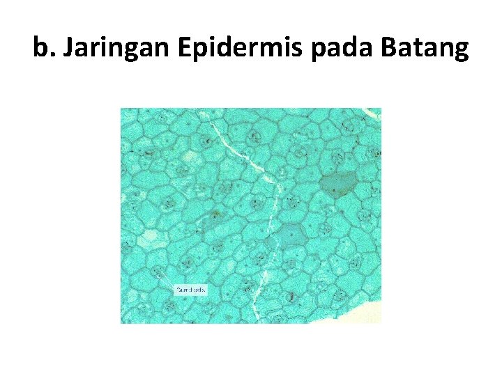 b. Jaringan Epidermis pada Batang 