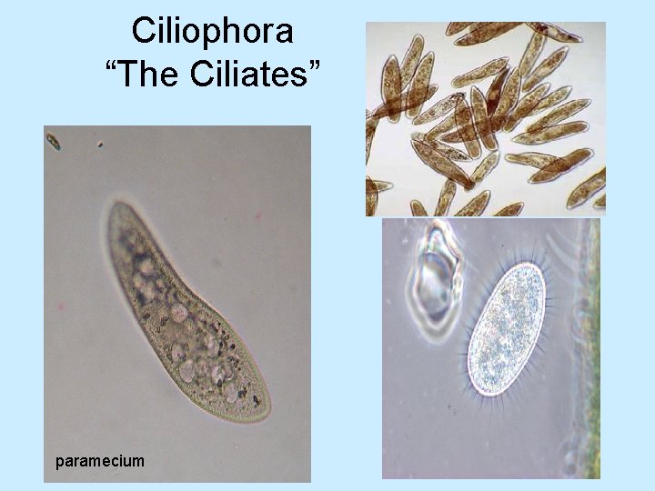 Ciliophora “The Ciliates” paramecium 