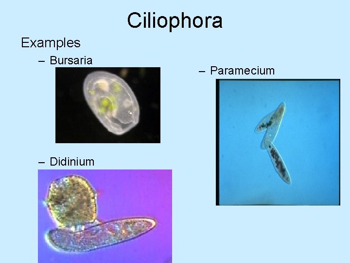 Ciliophora Examples – Bursaria – Didinium – Paramecium 