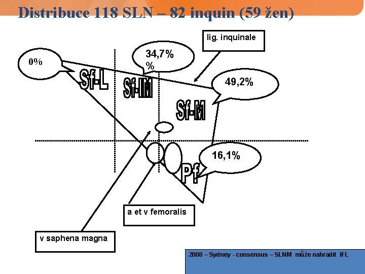 Distribuce 118 SLN – 82 inquin (59 žen) lig. inquinale 0% 34, 7% %