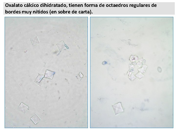 Oxalato cálcico dihidratado, tienen forma de octaedros regulares de bordes muy nítidos (en sobre