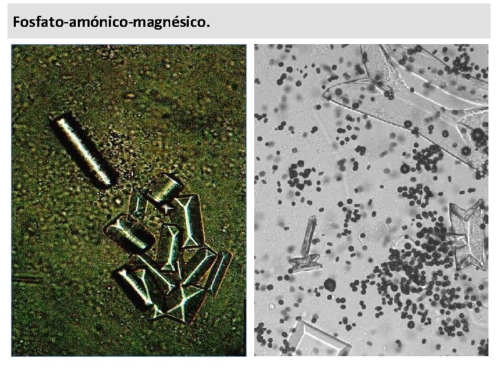 Fosfato-amónico-magnésico. 
