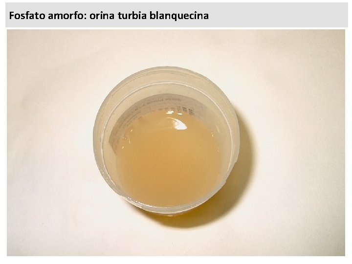 Fosfato amorfo: orina turbia blanquecina 