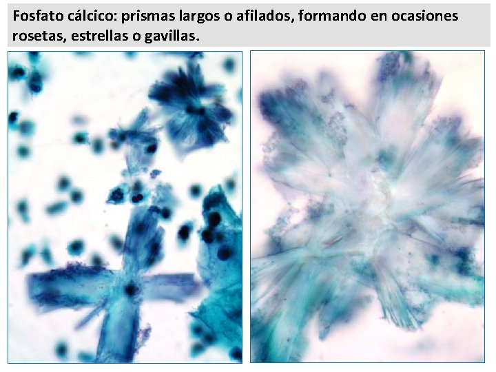 Fosfato cálcico: prismas largos o afilados, formando en ocasiones rosetas, estrellas o gavillas. 