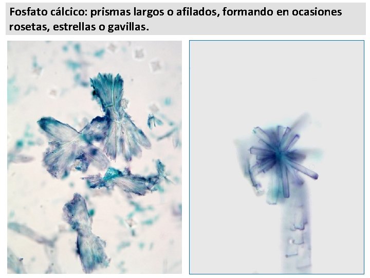 Fosfato cálcico: prismas largos o afilados, formando en ocasiones rosetas, estrellas o gavillas. 