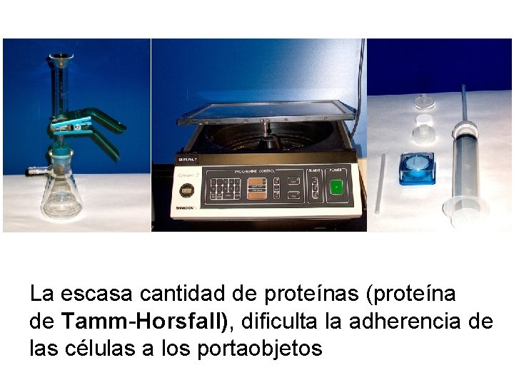 La escasa cantidad de proteínas (proteína de Tamm-Horsfall), dificulta la adherencia de las células