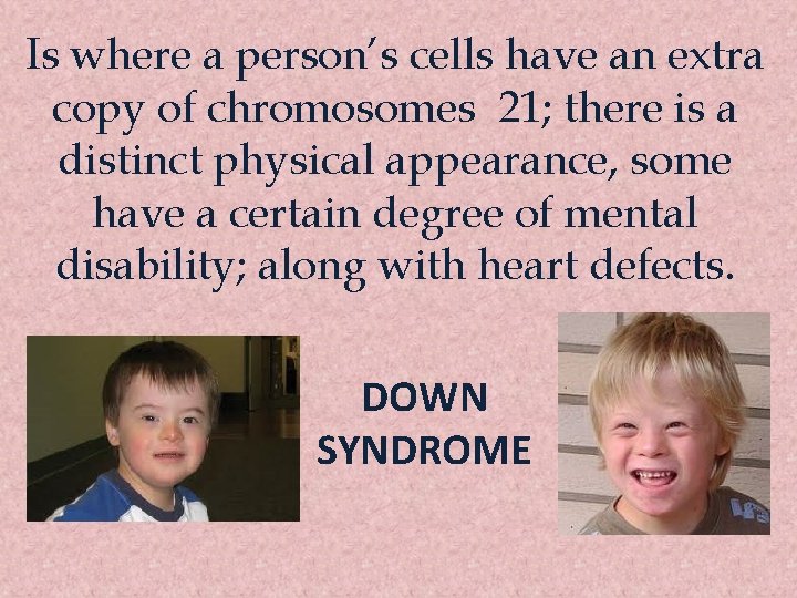 Is where a person’s cells have an extra copy of chromosomes 21; there is