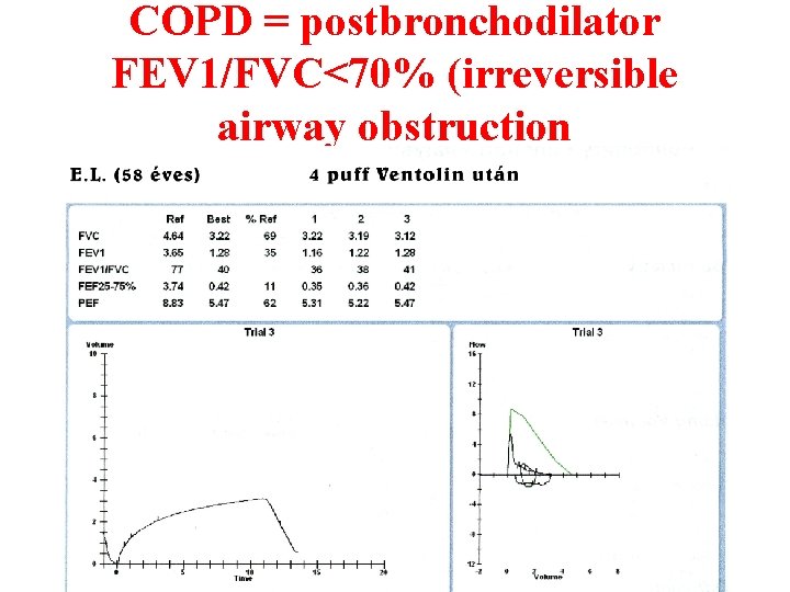 COPD = postbronchodilator FEV 1/FVC<70% (irreversible airway obstruction 