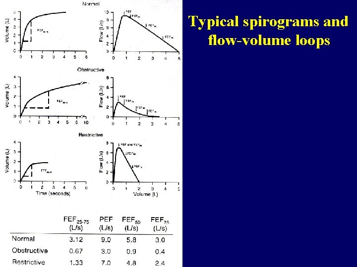 Typical spirograms and flow-volume loops 