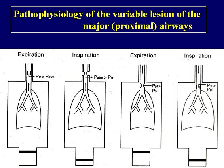 Pathophysiology of the variable lesion of the major (proximal) airways 
