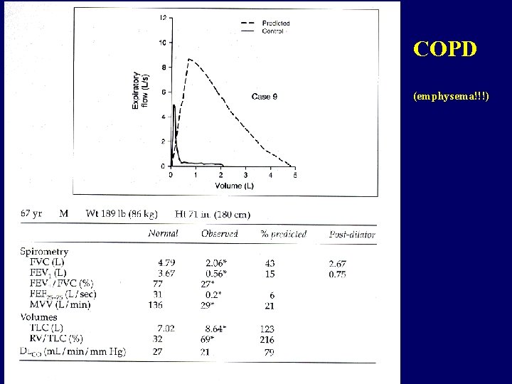 COPD (emphysema!!!) 