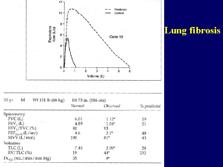 Lung fibrosis 