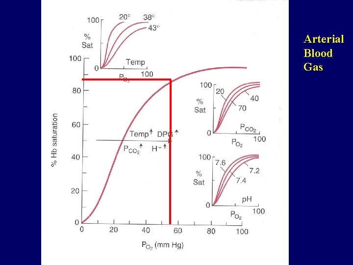 Arterial Blood Gas 