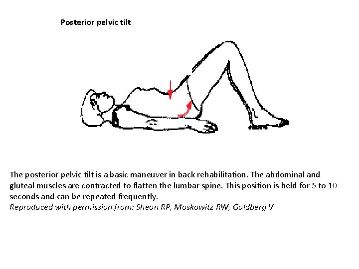 Posterior pelvic tilt The posterior pelvic tilt is a basic maneuver in back rehabilitation.