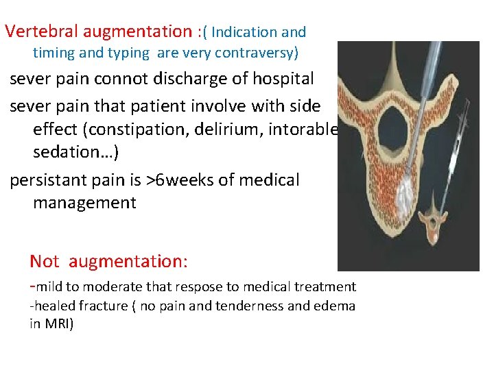 Vertebral augmentation : ( Indication and timing and typing are very contraversy) sever pain