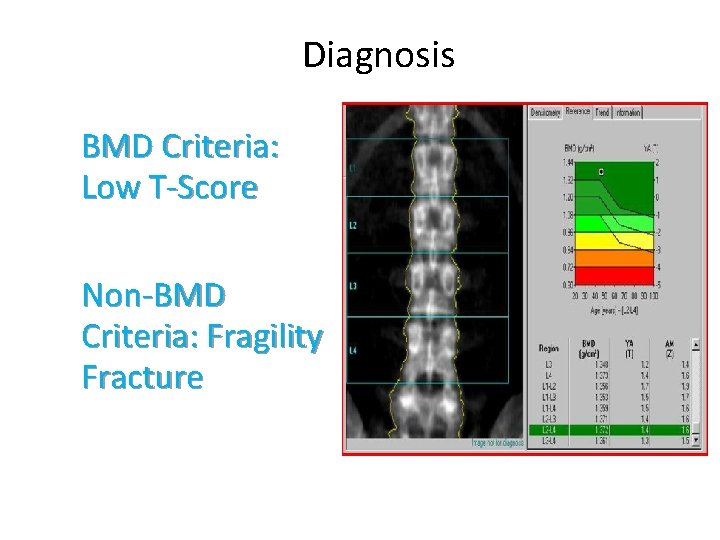 Diagnosis BMD Criteria: Low T-Score Non-BMD Criteria: Fragility Fracture 