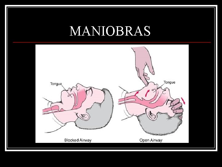 MANIOBRAS 