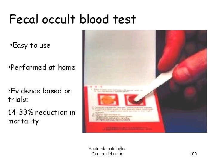 Fecal occult blood test • Easy to use • Performed at home • Evidence