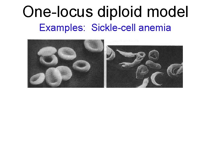 One-locus diploid model Examples: Sickle-cell anemia 