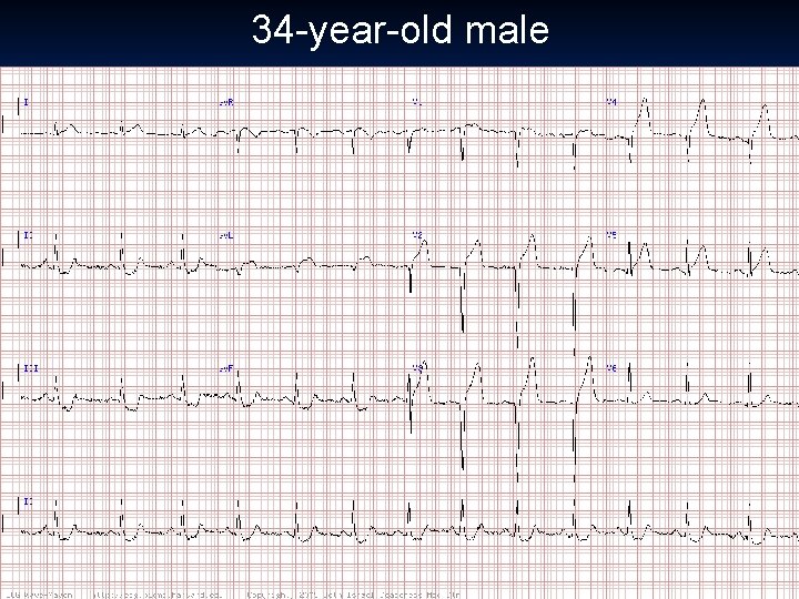 34 -year-old male 